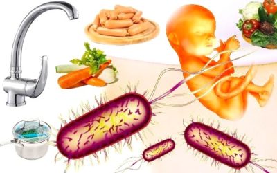 Listeria negli alimenti: un batterio che può uccidere 9