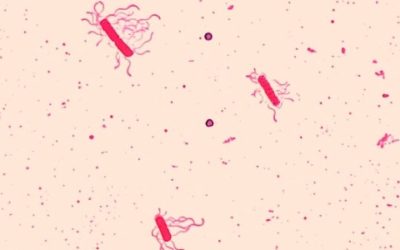 Bacillus Cereus: ecco il responsabile di tantissime infezioni alimentari 6